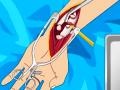 Permainan Arm surgery 2